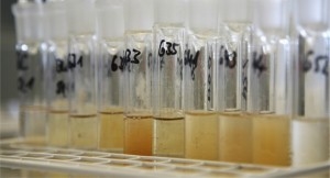 Controle urine