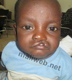 Bakary Coulibaly
