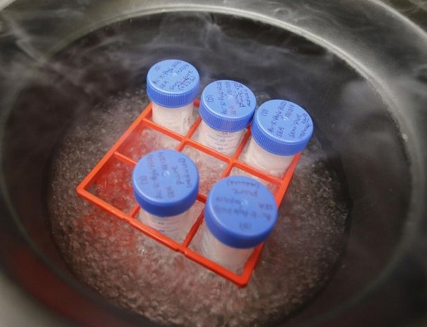 Ebola : la France va expérimenter des tests de diagnostic rapide en Guinée