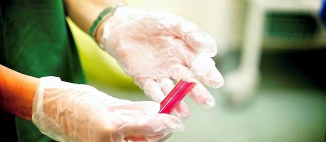 Prélèvement pour un laboratoire (photo d'illustration). © L. SOUCI