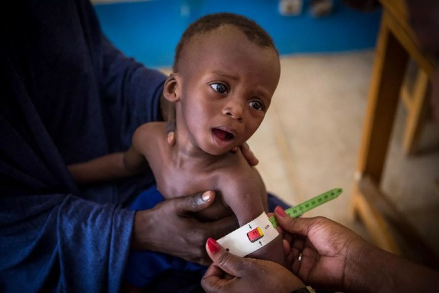 Nutrition en 2024 : Parent pauvre du budget national