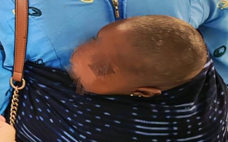 Protéger le cuir chevelu délicat de votre bébé :  Diagnostic, traitement et soins à domicile pour la teigne, des interprétations de la mission médicale chinoise au Mali