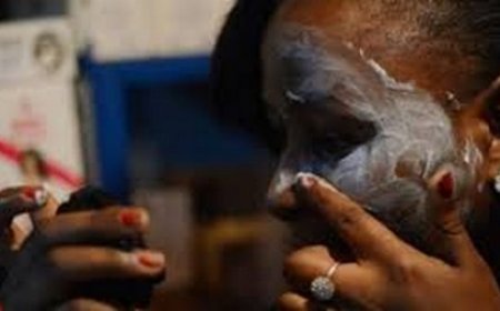Dépigmentation : Entre idéal de beauté et  danger pour la santé
