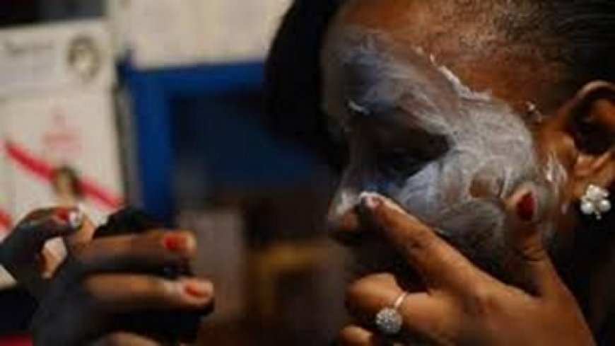 Dépigmentation : Entre idéal de beauté et  danger pour la santé
