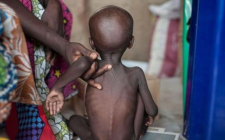 Malnutrition : Le mal silencieux qui commence dans l'assiette