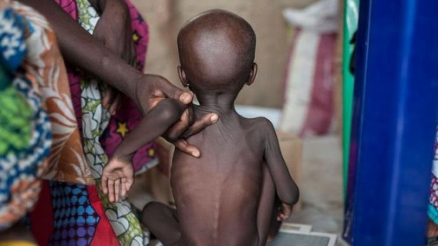 Malnutrition : Le mal silencieux qui commence dans l'assiette