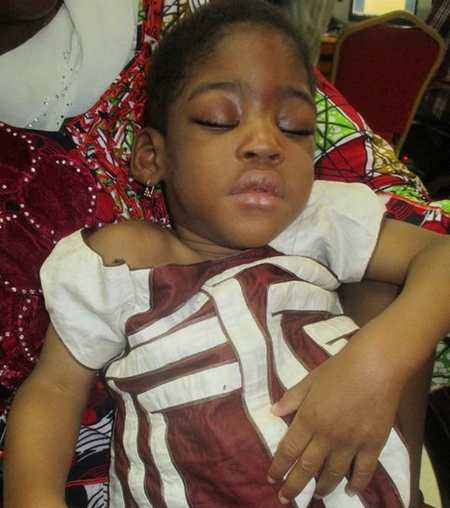 Atteinte d’une atrophie cérébrale congénitale :  Le bébé Fatoumata Diarra a urgemment besoin de  soins