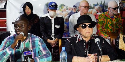 Assassinat des albinos :  Un crime de plus en plus fréquent
