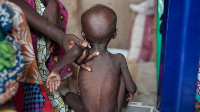 Lutte contre la malnutrition  au  Mali :  L'adoption de bonnes pratiques recommandées